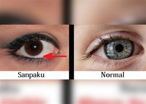 What are Sanpaku Eyes? And What They Mean for Your Future - ZestVine - 2025