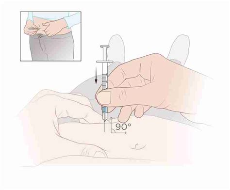 Image result for SubQ Injection Technique