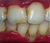 Indian Dental Association