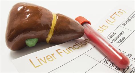 Image result for Liver Function Labs