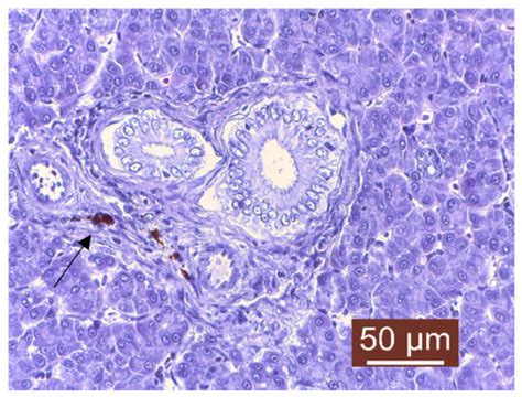 Septicemic Outbreak in A Rainbow Trout Intensive Aquaculture System ...