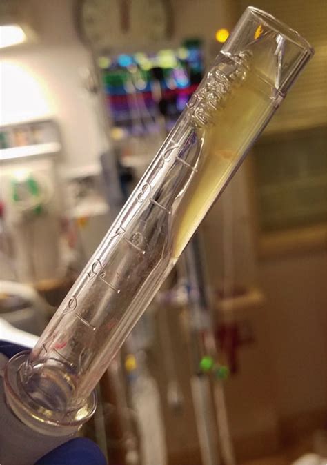 Image result for CSF Sample Syringe