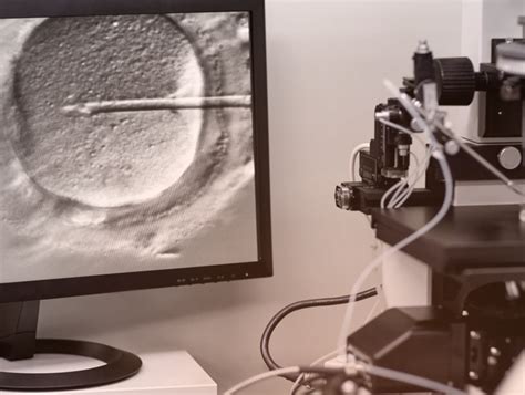 IVF Process Step by Step 的图像结果