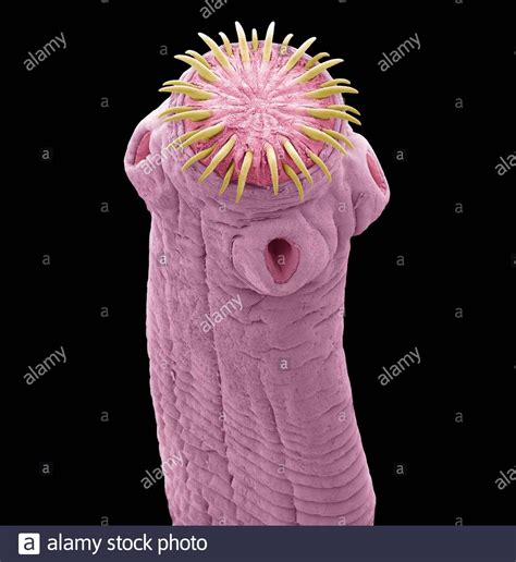 Tapeworm Under A Microscope