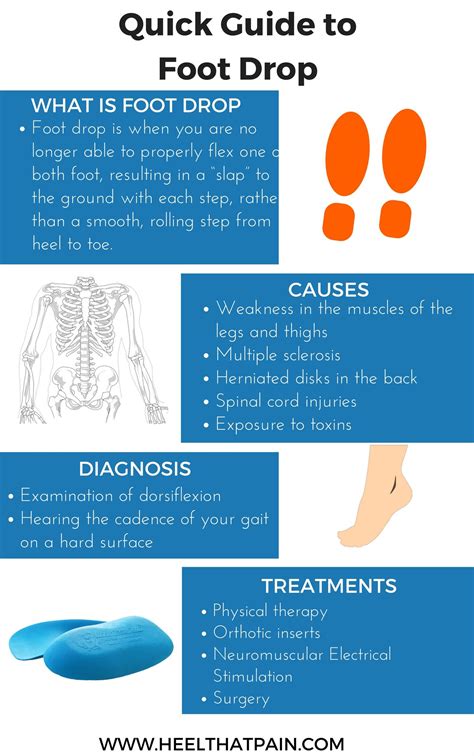 The foot drop test 5 easy exercises for the diagnosis of early drop foot signs – Artofit
