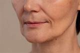 Sagging Jowls: Causes, Treatment, and Prevention - Bodycraft - Salon ...