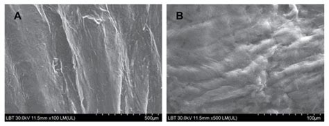 Evidence of SARS-CoV-2 Virus in the Middle Ear of Deceased COVID-19 ...