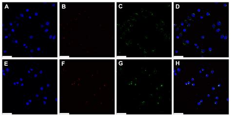 Polyethylenimine-Conjugated Hydroxyethyl Cellulose for Doxorubicin/Bcl ...