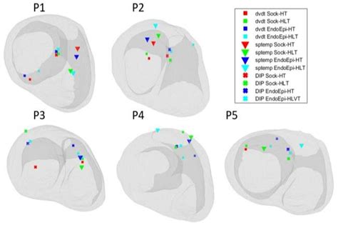 Image result for PVC Localization Chart