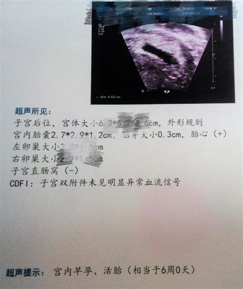 懷孕8周可以聽到胎心嗎 八周可以通過B超看到胎心 - 每日頭條
