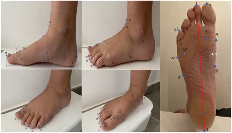 Validation of an Automated Optical Scanner for a Comprehensive ...