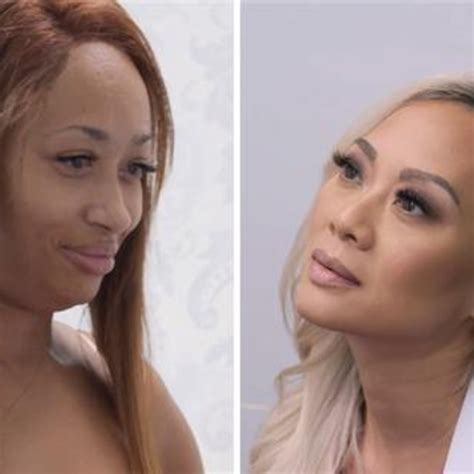 Woman Wants Excess Belly Skin Gone After Major Weight Loss