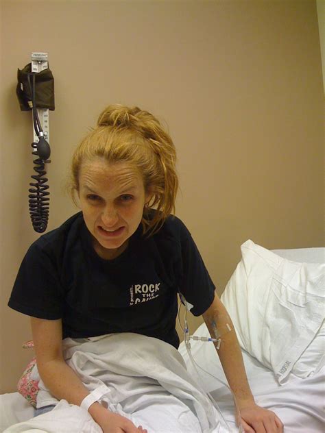 Image result for Exploding Colon