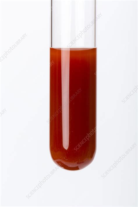 Image result for Benedict Test