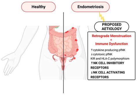 Natural Killer Cell Receptors and Endometriosis: A Systematic Review