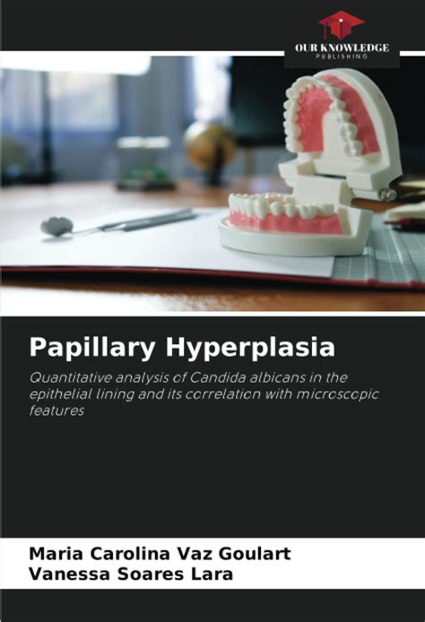 Buy Papillary Hyperplasia Book Online at Low Prices in India ...