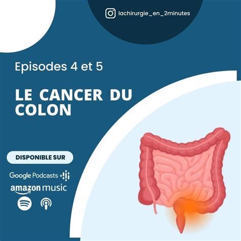 Les cancers du colon et du rectum : Traitement • Podcast • La chirurgie en 2 minutes