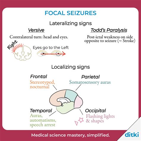 Focal Seizures | Medical science, Medical school essentials, Physical therapy assistant