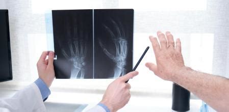 Artrosis: 10 consejos para mejorar sus síntomas