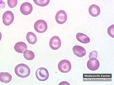 Image result for Target Cells