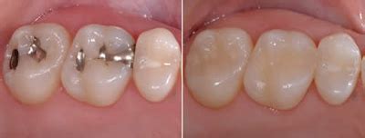 Dr. Shah Dental Square | Dr. Ronak Shah | Dr. Tapasi Shah | Dentist In ...