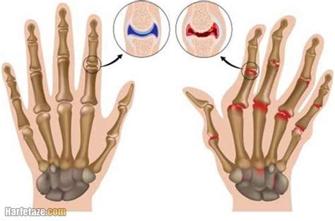 اگر درد دست امانتان را بریده با کلینیک تخصصی دکتر دست همراه شوید... حرف ...