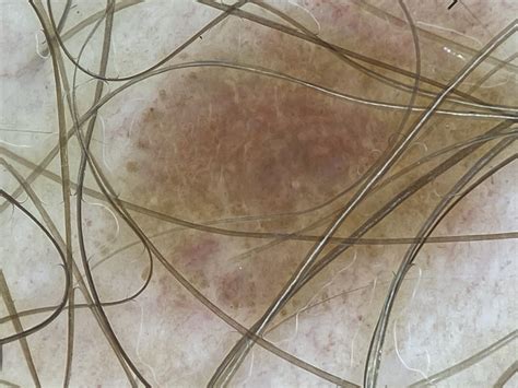 W poniedziałek 11.12.2024 w Kamiennej Górze odbyły się badania profilaktyczne! - Old Town ...