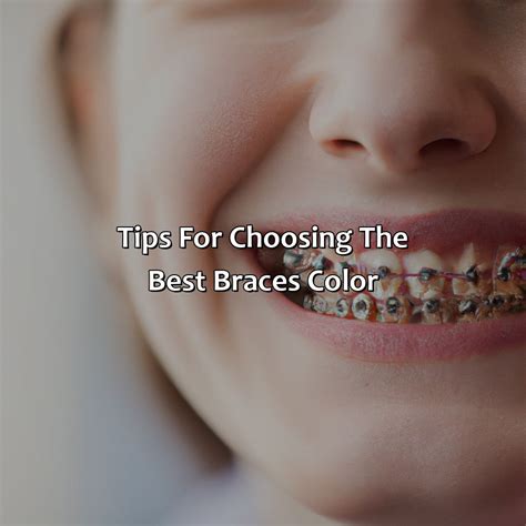 What Is The Best Braces Color - colorscombo.com