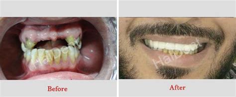 Smile Gallery | Dental Clinic