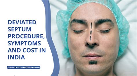 Deviated Septum Recovery Splint