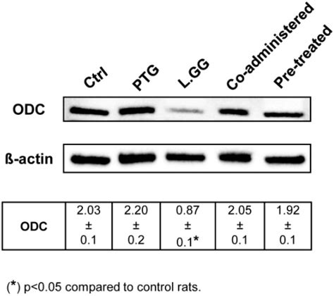 Lactobacillus rhamnosus GG Protects the Epithelial Barrier of Wistar ...