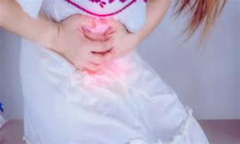 Preoperative D-Dimer has Limited Role in Predicting Ovarian Torsion ...