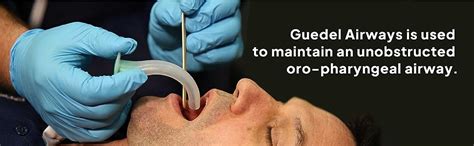 OTICA Easy Cleaning/Smooth Airway Path Guedel Airway Box : Amazon.in ...
