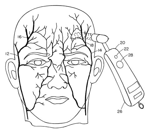 Temporal artery temperature detector - Eureka | Patsnap