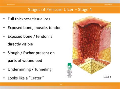 Wound Management | PPTX