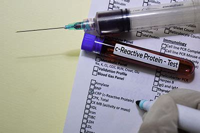 Resultado de imagen de c reactive protein zu hoch