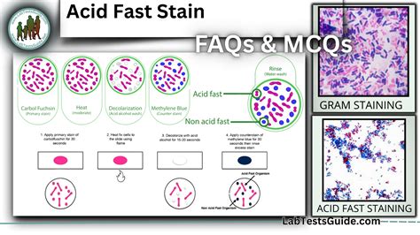 Acid Fast Stain 50 FAQs and 30 MCQs | Lab Tests Guide