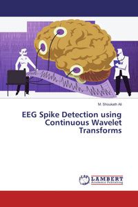 EEG Spike Detection using Continuous Wavelet Transforms: Buy EEG Spike ...