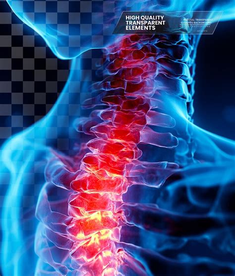 A graphic depicting neck pain showing the symptoms on transparent ...