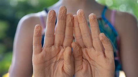 Why Does The Skin Of Your Finger Shrink When You Wash Clothes For A ...