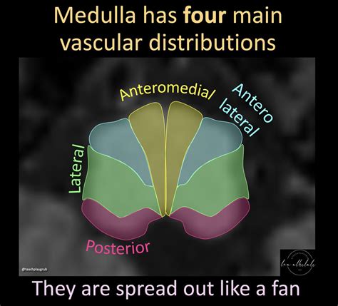 1/The medulla is anything but DULL! Does seeing an infarct in the medulla cause your heart to ...