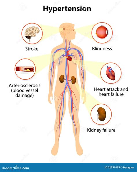 Dangers of high blood pressure online