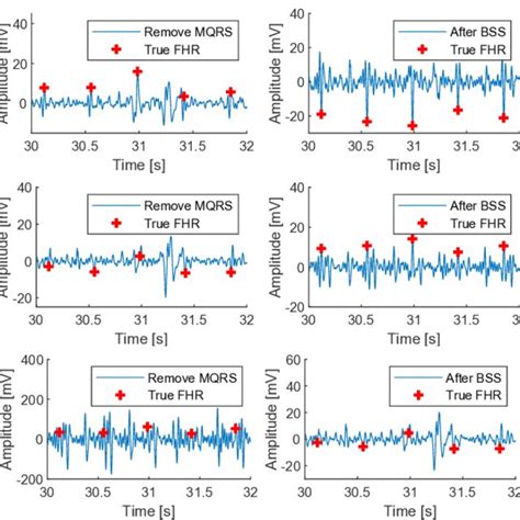 Image result for BSS Scripts Tutorial