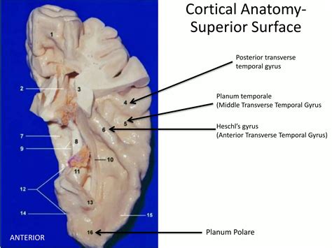 Final microsurgical anatomy of medial temporal lobe | PPTX
