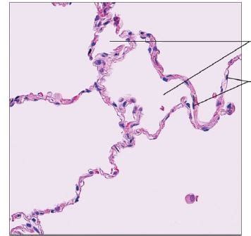 Image result for Ephilehal Tissue Sample