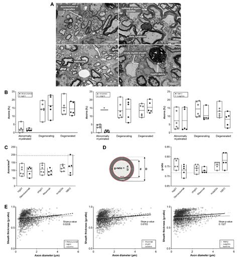 Effects of a Fully Humanized Type II Anti-CD20 Monoclonal Antibody on ...