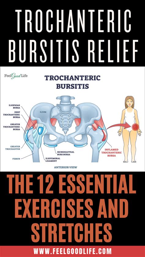 Trochanteric bursitis 12 best exercises and stretches – Artofit