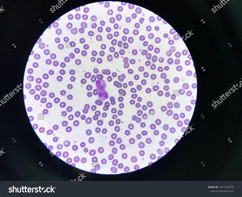 White Blood Cells Neutrophil Band Neutrophil Stock Photo 1051220378 ...