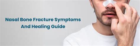 Nasal Fracture: Symptoms & Healing Guide