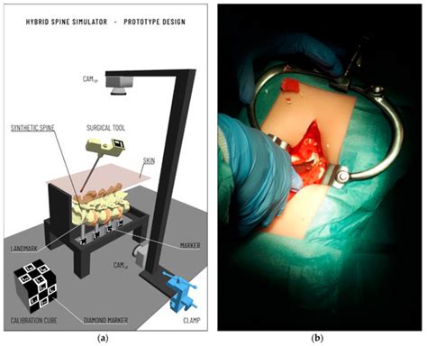Hybrid Spine Simulator Prototype for X-ray Free Pedicle Screws Fixation ...